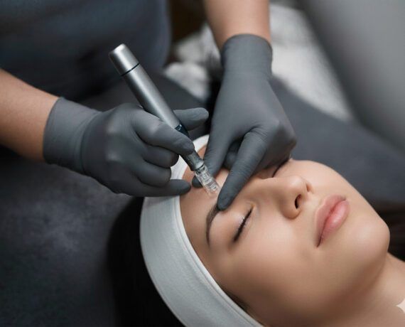 Microneedling kezelés precíz előkészítése